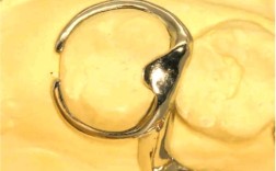 牙科卡环焊接方法有哪些关键操作要点？