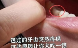 种牙 一周了还是痛