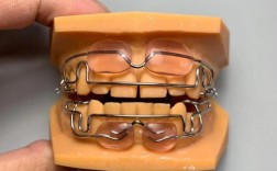 牙齿矫正器品牌有哪些？热门品牌大盘点！