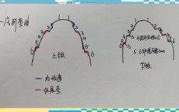正畸横腭杆弯制方法的关键步骤、操作技巧及注意事项有哪些？