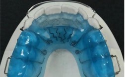 正畸全包式合垫能解决哪些牙齿矫正咬合问题？