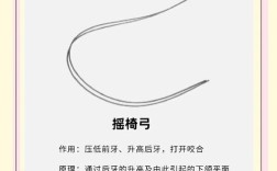 正畸中弓形的确定