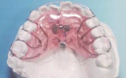 正畸常用活动矫治器