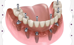 种牙植体后吃什么水果合适？术后饮食要注意啥？