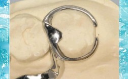 口腔正畸中卡环图片包含哪些常见类型及作用？