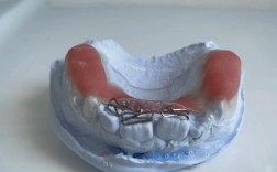 正畸双曲舌簧制作