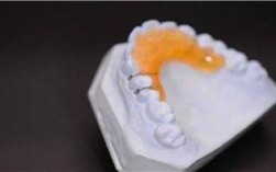 正畸斜面导板制作需掌握哪些核心技巧？