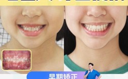 乳牙可以做正畸么