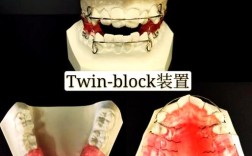 功能性牙齿矫正器，与传统矫正有何不同？