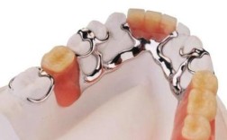 活动义齿为何要改种牙？优势在哪里？