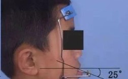 地包天正畸后反弹了怎么办？如何有效处理并预防反弹？