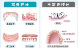 为什么要及时种植牙