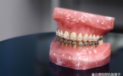 乌鲁木齐牙齿正畸效果如何？价格大概多少？适合哪些人？