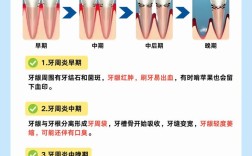 种牙前必须先治疗牙周吗？