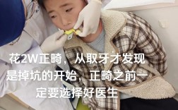 武汉大学口腔矫正牙齿效果怎么样？