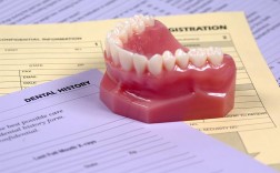 深圳allon4种植牙