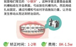 成年矫正牙齿费用多少？一篇读懂价格与影响因素