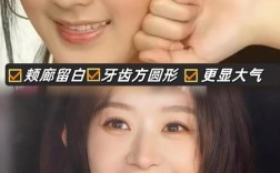 明星为何高龄矫正牙齿？晚矫正效果如何？