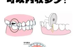 压低大牙的方法有哪些？效果和注意事项如何？