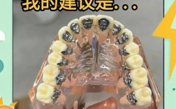 杭州舌侧正畸牙医技术如何？效果好不好？怎么选？