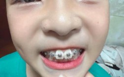 永川矫正牙齿哪里好