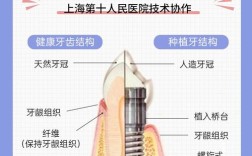 种牙和种植牙究竟哪个说法更准确？两者在专业定义、手术方式及效果上存在哪些差异？