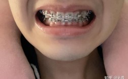 武汉口腔医院矫正牙齿哪家好？效果靠谱吗？