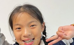 矫正牙齿能改善下巴形态吗？