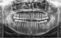 正畸减数牙拍全景片，到底能解决哪些关键问题？