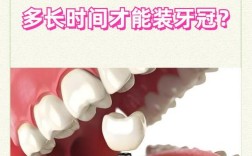 种牙的钉子能用多久？使用寿命受哪些因素影响？