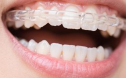 牙套矫正牙齿有用吗
