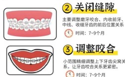 正畸分牙过程是怎样的？为何分牙是矫正的关键一步？