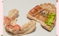 Tweed牙齿矫正技术有何独特优势？