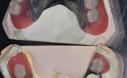 牙齿矫正会导致牙根断裂吗？断裂后还能继续矫正吗？