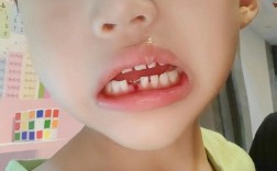 一颗牙没有可种牙吗