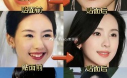 明星矫正牙齿前后反差有多大？效果惊艳还是另有隐情？