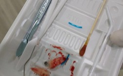 正畸拔牙麻药多久会消失？拔牙后多久能恢复感觉？