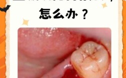 牙龈止血的方法