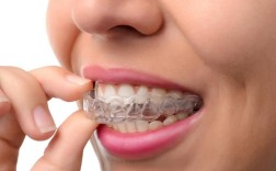 牙齿矫正带什么牙套好