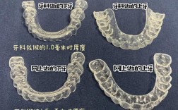 如何正确弯制上颌保持器？关键步骤与临床方法解析