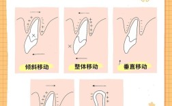矫正牙齿移动速度多少算合适？