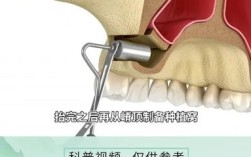 种牙外提手术视频能看清哪些关键步骤？