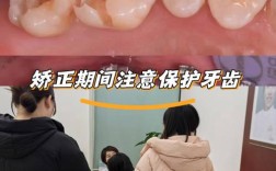 蛀牙能做牙齿矫正吗？