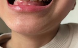 小孩牙齿矫正酸痛？原因和缓解方法是什么？