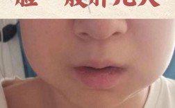 刚种完牙后会有哪些常见症状？