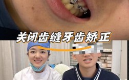 厦门哪家牙齿矫正