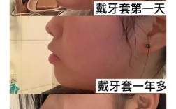 牙齿修复和正畸，目标与方法有何不同？