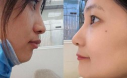 天津河西口腔正畸医院怎么选？效果好不好？价格贵不贵？