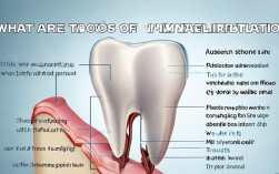 2025种植牙最新禁忌，哪些人不能种？