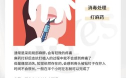 种植支抗钉植入的具体操作步骤有哪些？不同牙位植入时如何选择入路角度及避免损伤重要解剖结构？